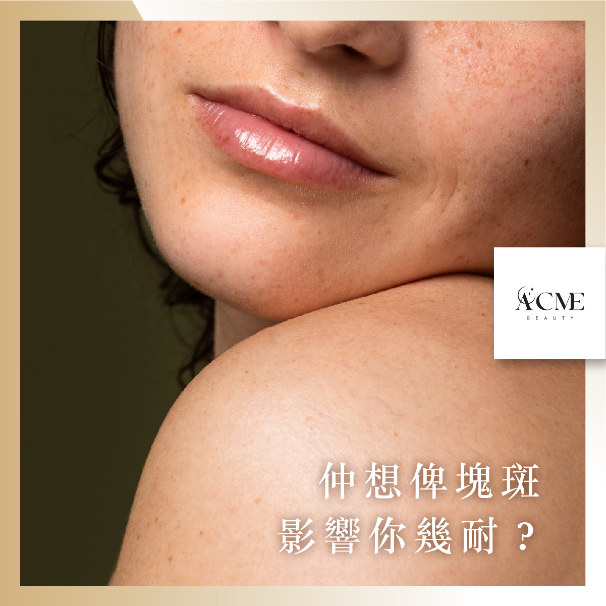 AcmeBeauty-想輕鬆獲得小蠻腰？
