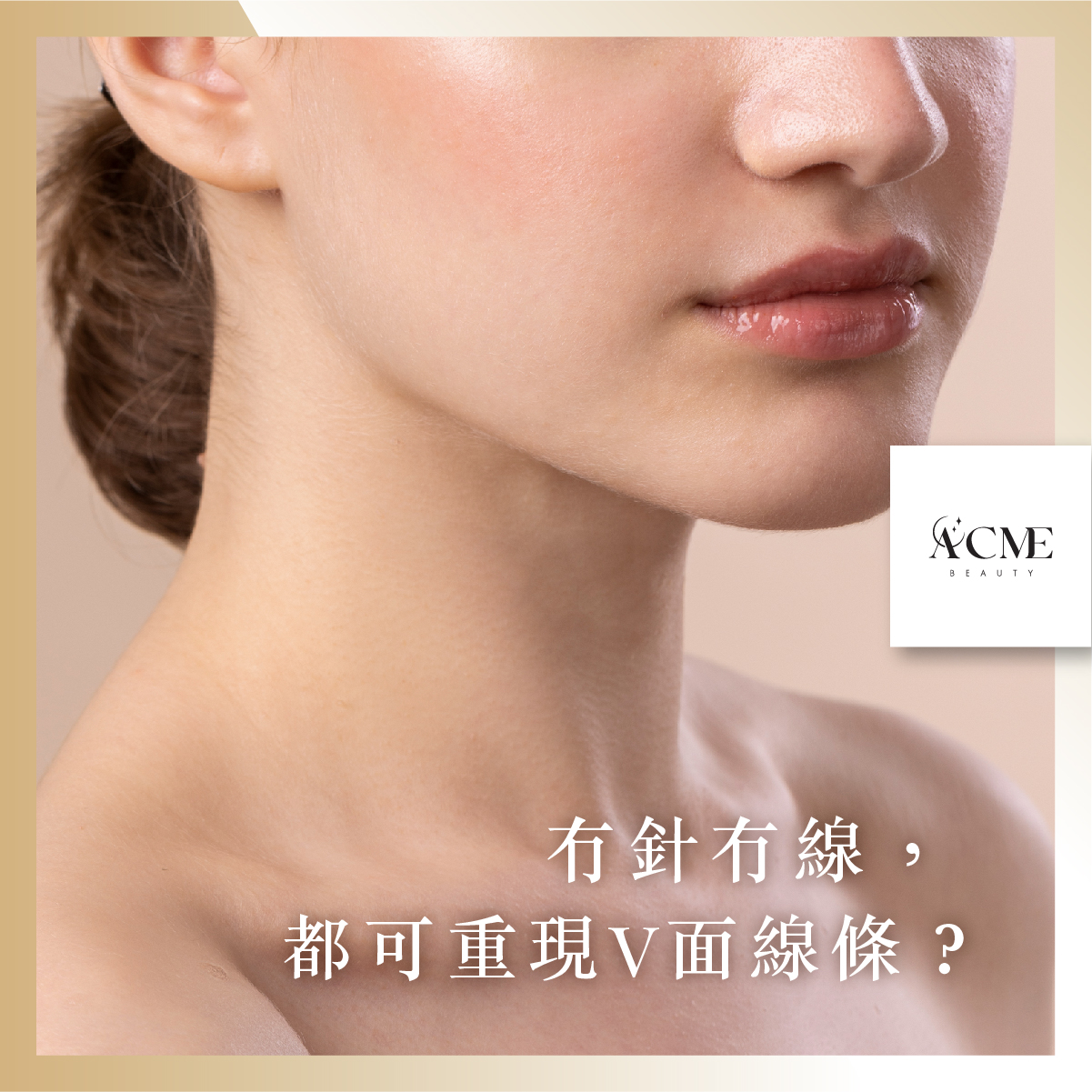AcmeBeauty-想輕鬆獲得小蠻腰？
