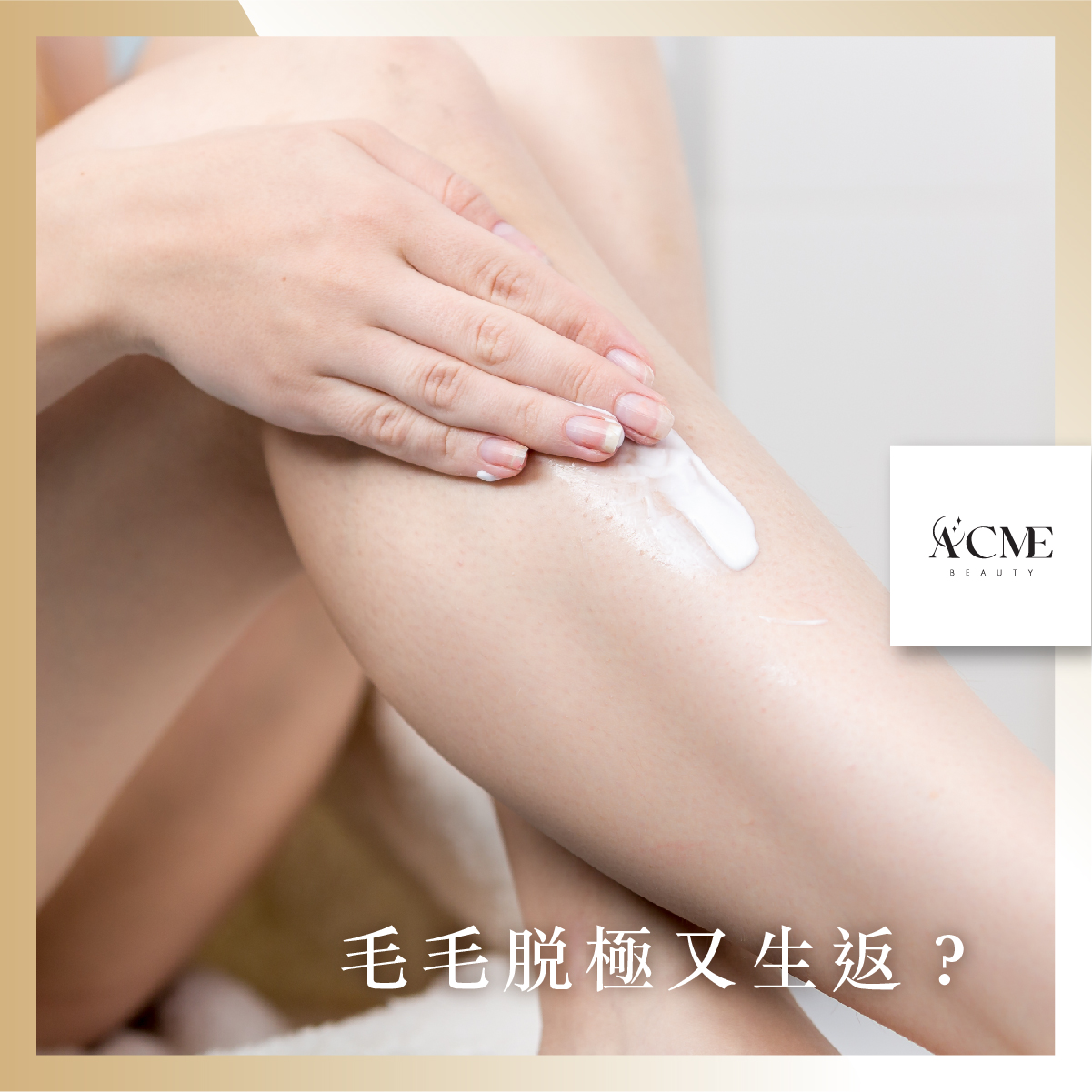 AcmeBeauty-想輕鬆獲得小蠻腰？
