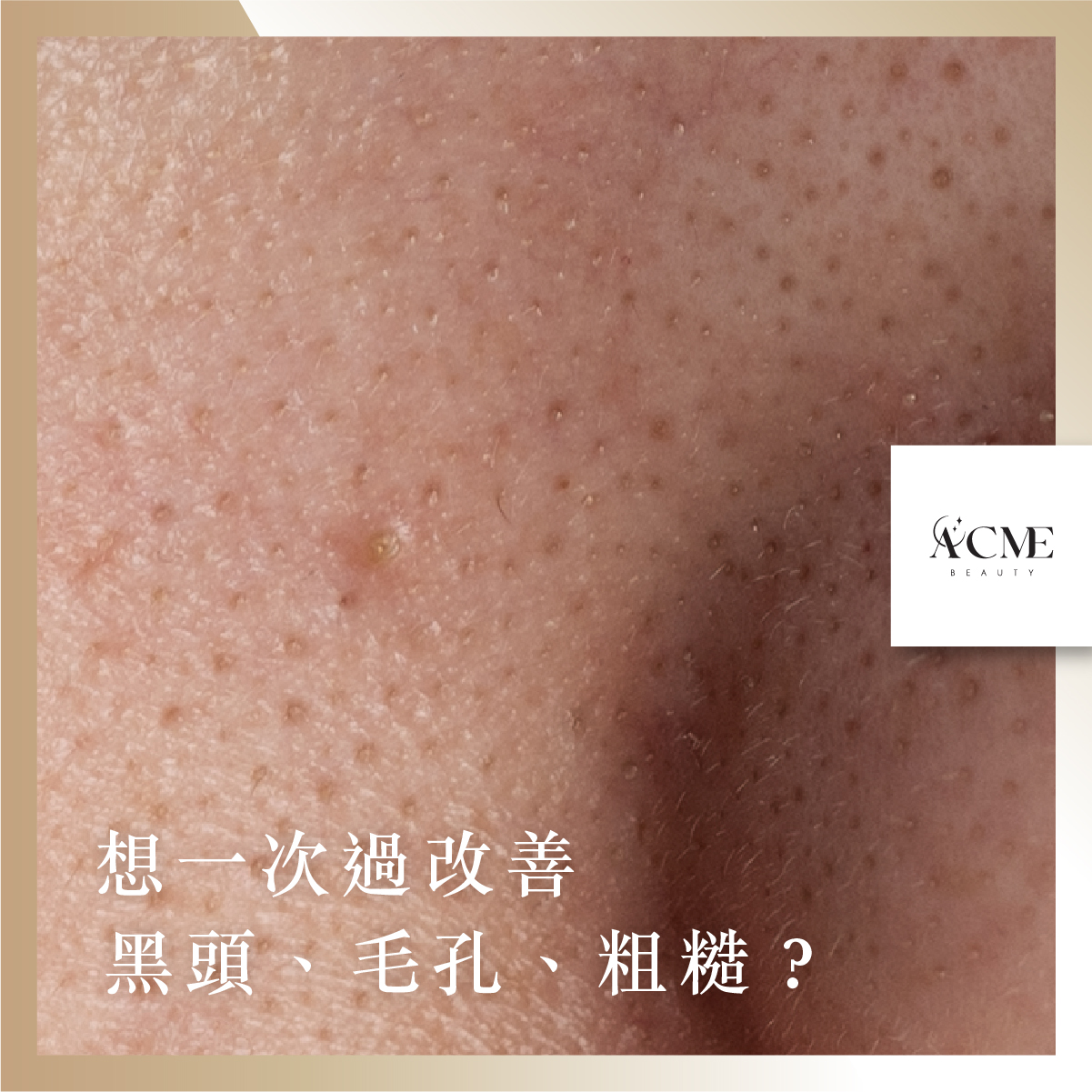 AcmeBeauty-想輕鬆獲得小蠻腰？