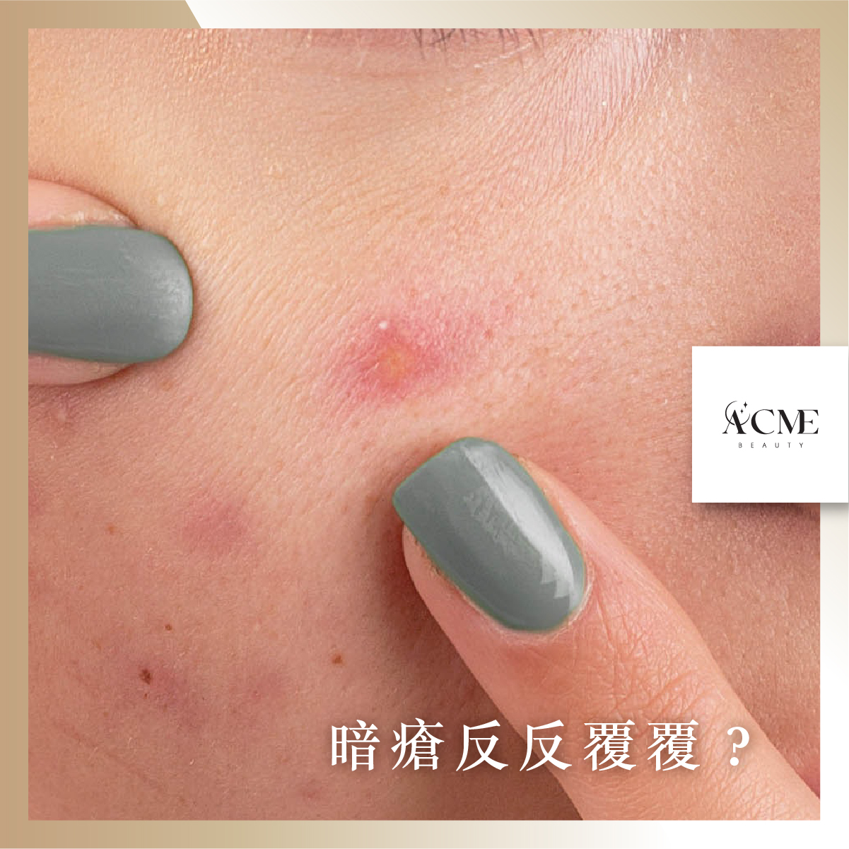 AcmeBeauty-想輕鬆獲得小蠻腰？