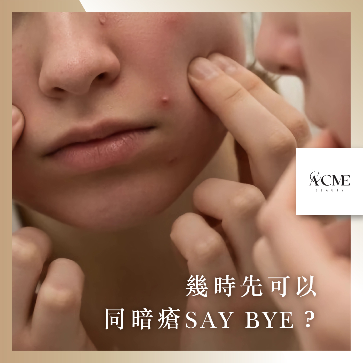 AcmeBeauty-想輕鬆獲得小蠻腰？