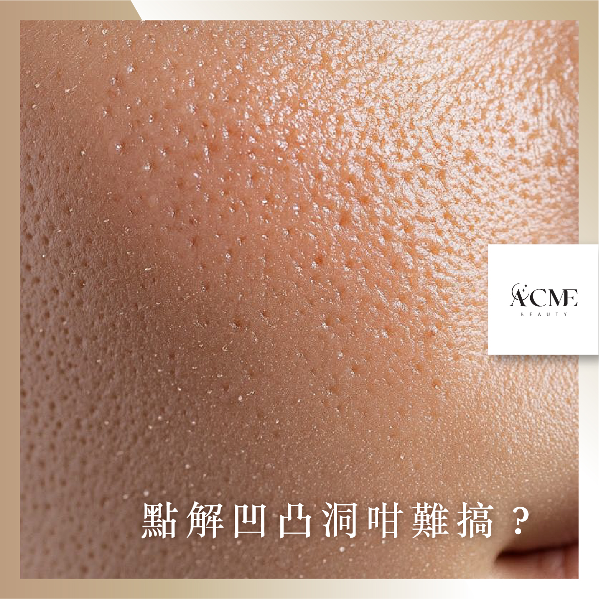 AcmeBeauty-想輕鬆獲得小蠻腰？