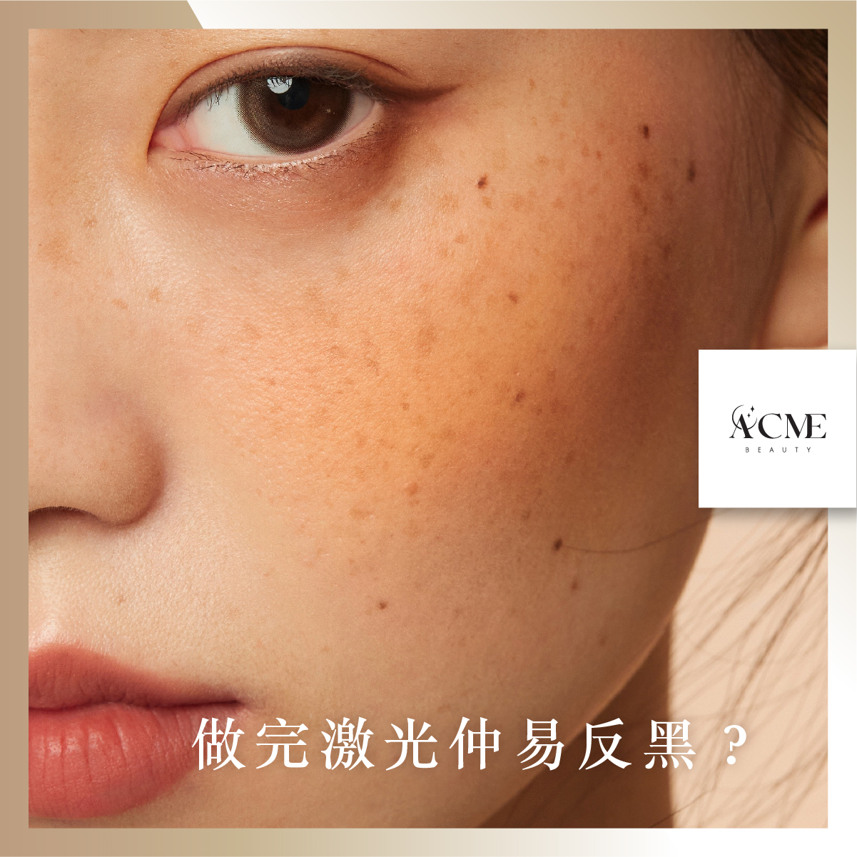 AcmeBeauty-想輕鬆獲得小蠻腰？