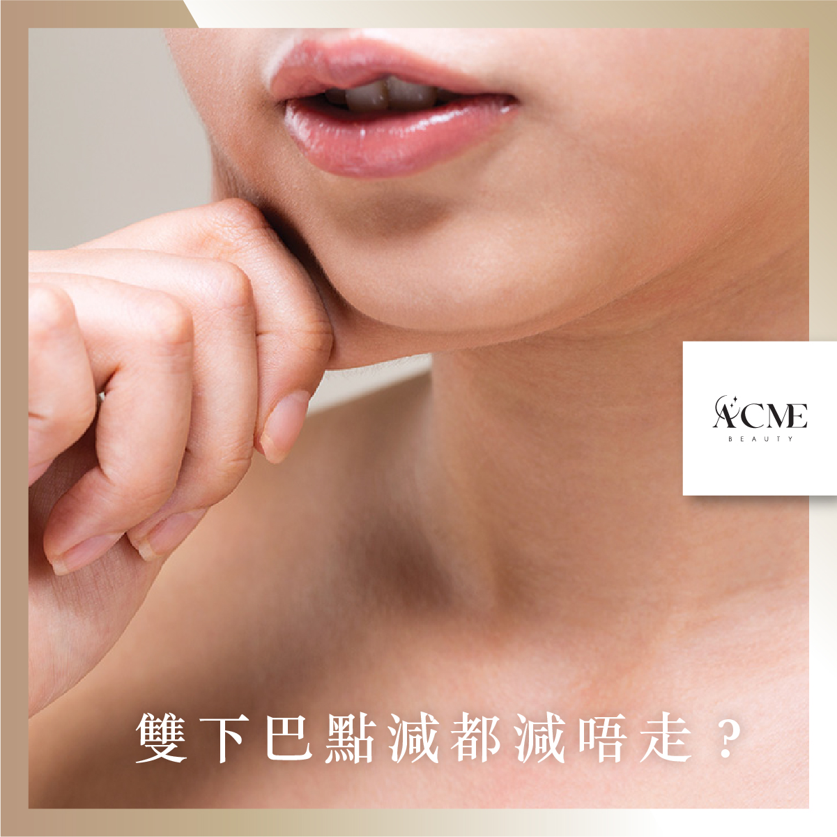 AcmeBeauty-想輕鬆獲得小蠻腰？
