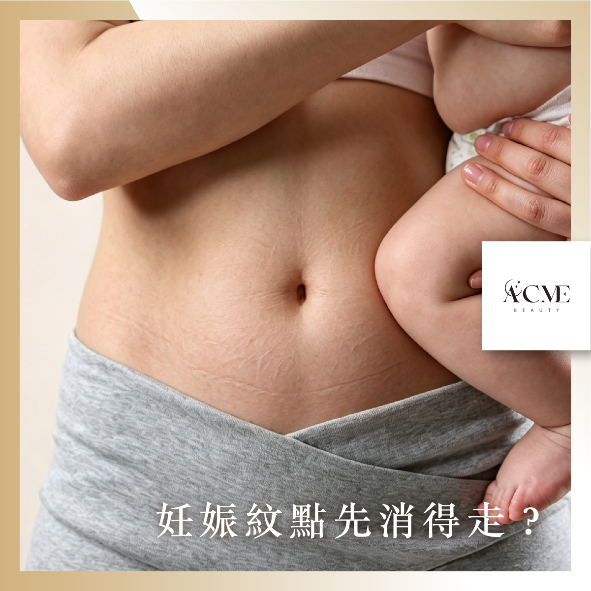 AcmeBeauty-想輕鬆獲得小蠻腰？