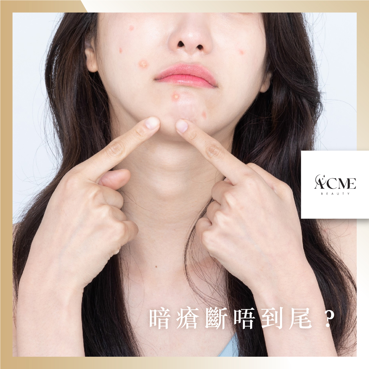 AcmeBeauty-想輕鬆獲得小蠻腰？
