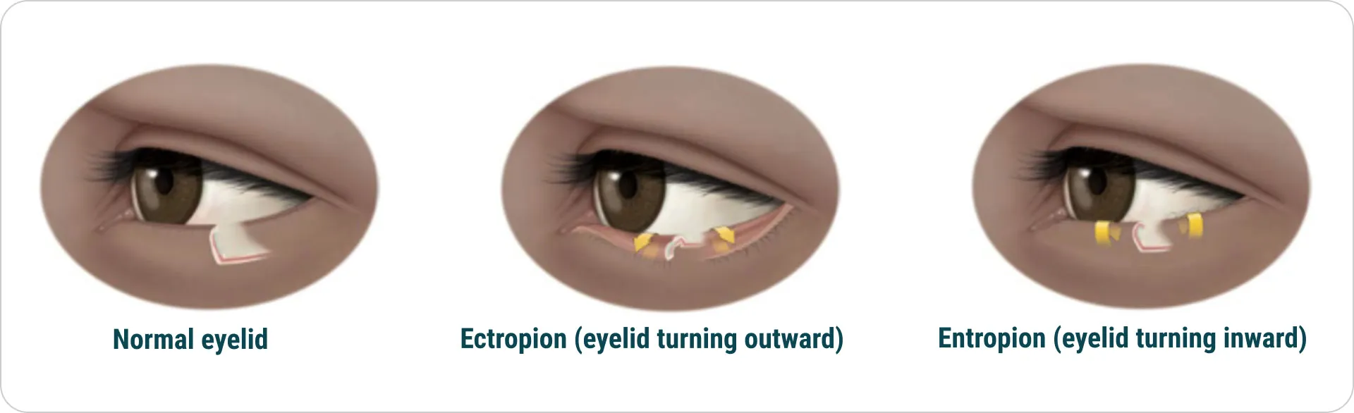 eyelid diagram