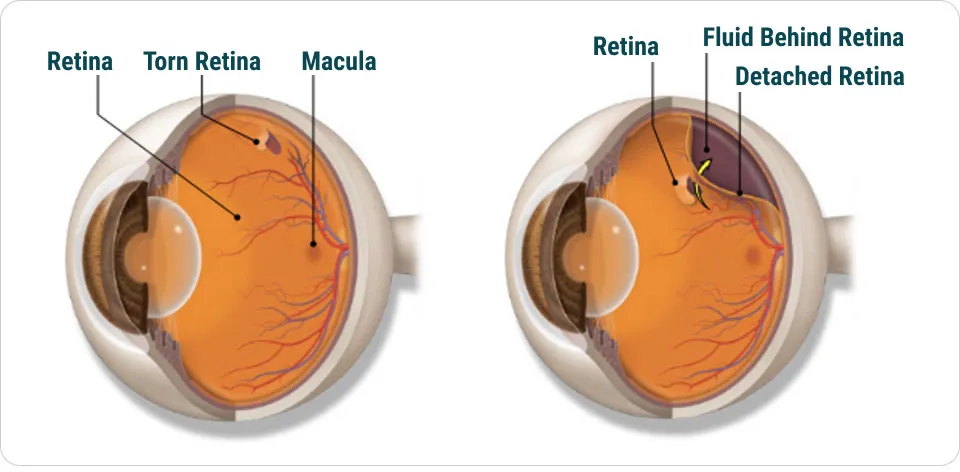 retina diagram