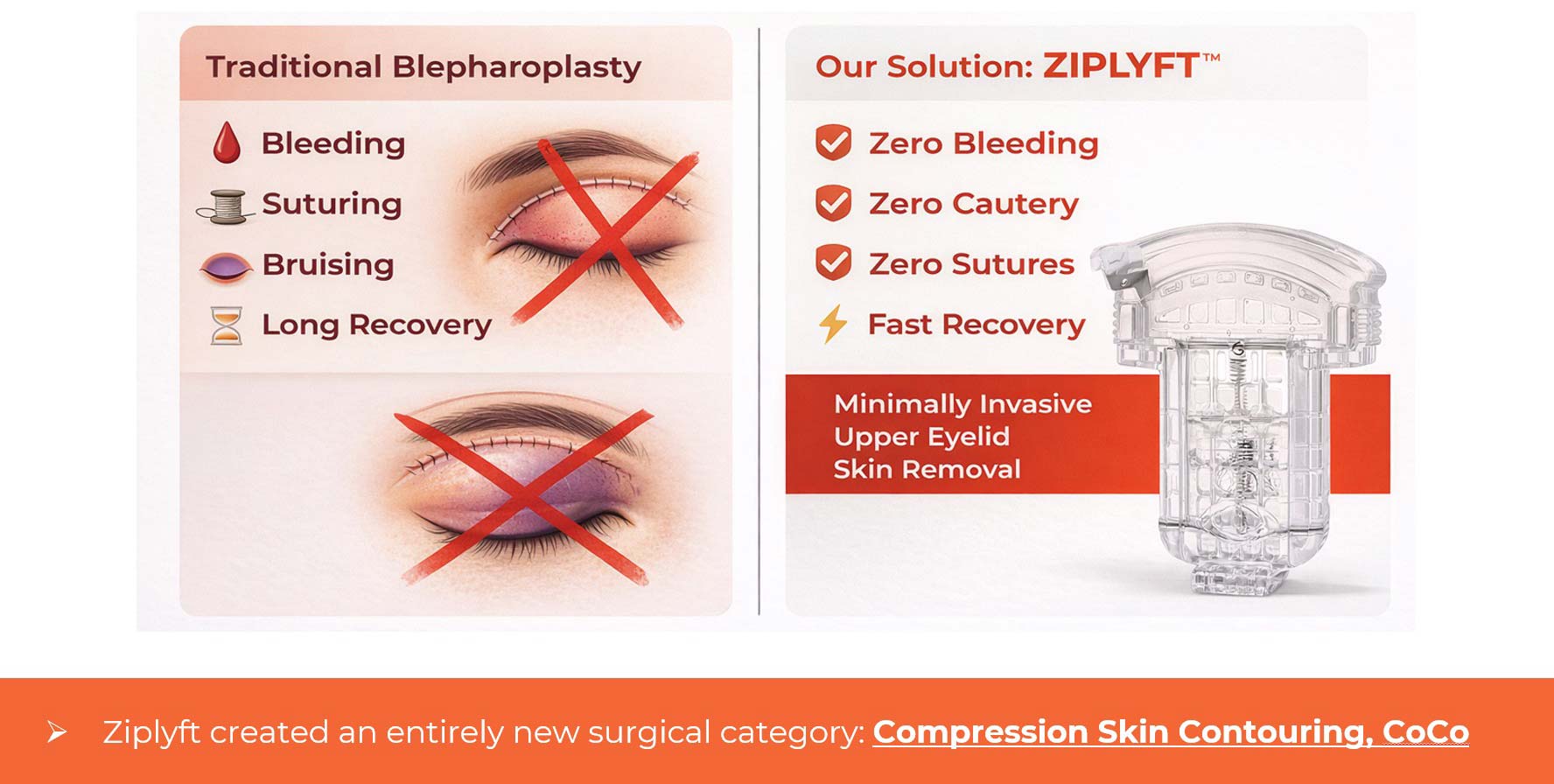 ziplyft banner