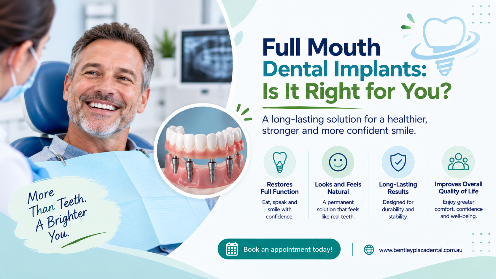 Full Mouth Dental Implants: Is It Right for You?