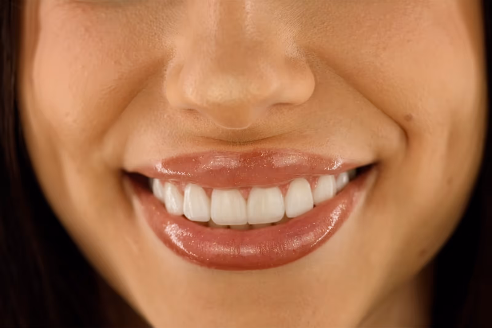 Closeup of a woman’s beautiful, natural-looking smile after a smile makeover from Sapphire Smiles Dentistry in Houston, TX