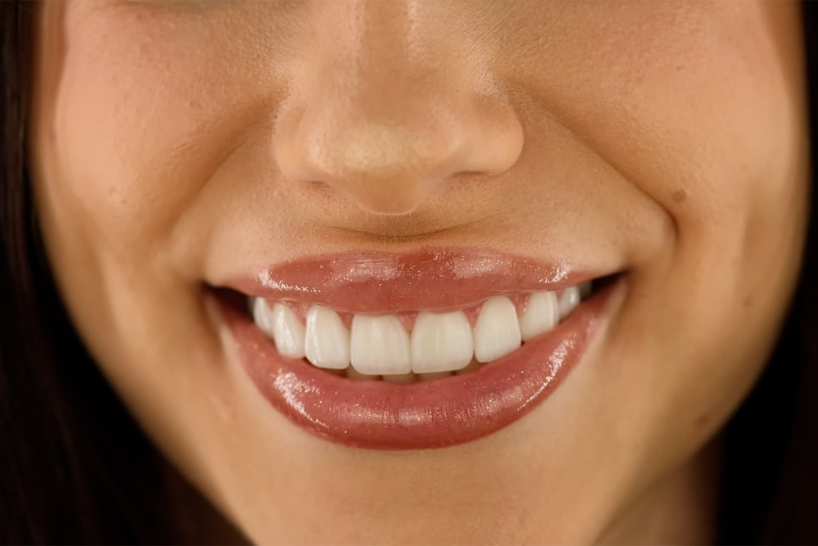 Closeup of a woman’s beautiful, natural-looking smile after a smile makeover from Sapphire Smiles Dentistry in Houston, TX
