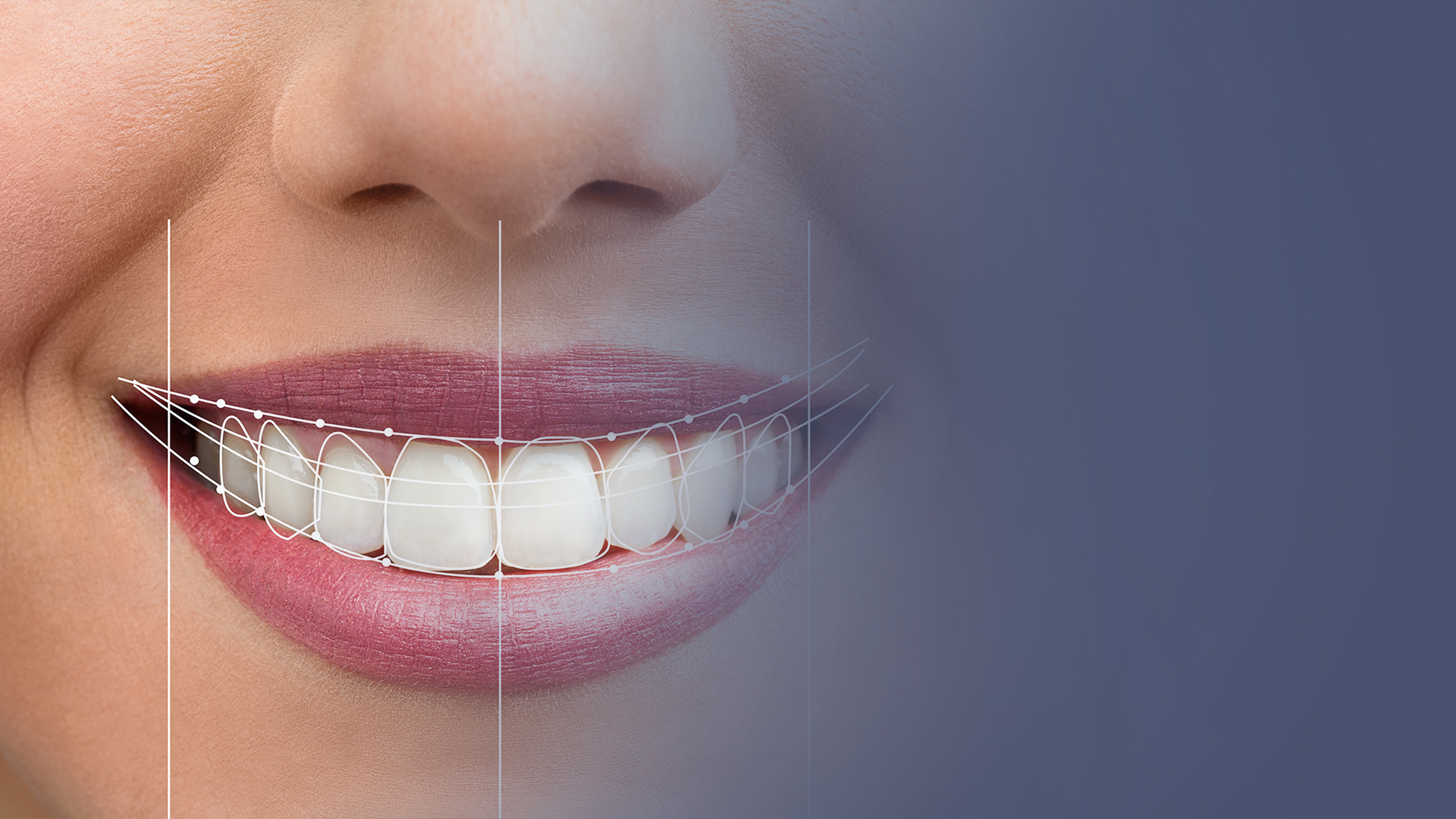 Digital Smile Design