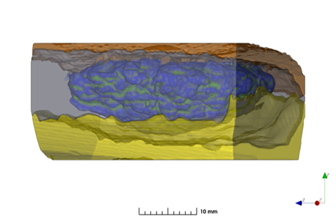 Injection Rate Impact on Long-acting Injectable Depot Dissolution in Ex Vivo Porcine Tissue