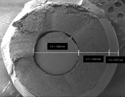 Brand vs Generic IUS systems