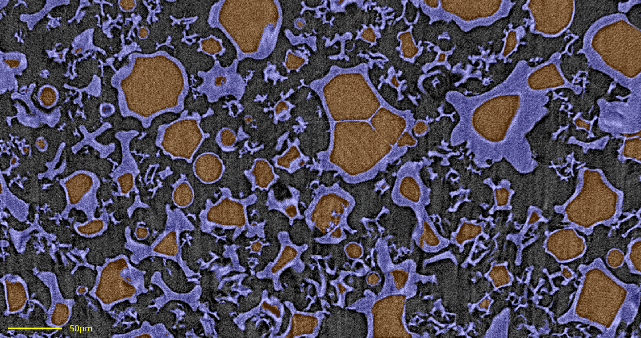 After: AI-segmented micro-CT scan of spray dried dispersion showing classified voids, walls, and particle regions