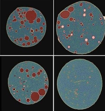 Impact of PEG Grade on Performance of Dexamethasone Ophthalmic Inserts
