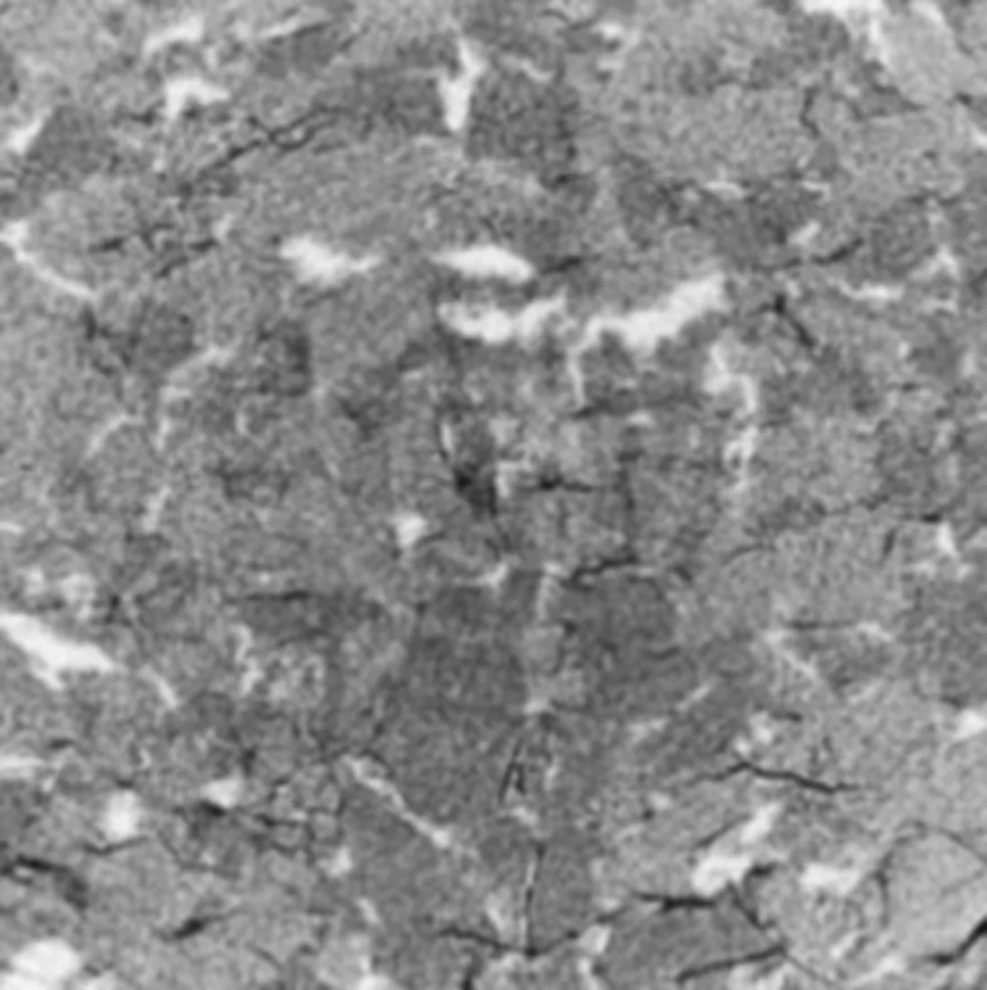 A microct slice of an amorphous solid dispersion, where we see a mixture of various excipients and crystalline materials.