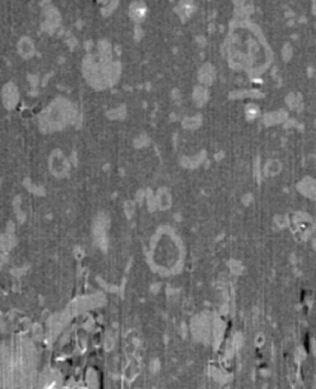 An FIB image of a long acting ocular implant with excipients, API, and pores evenly distributed throughout.