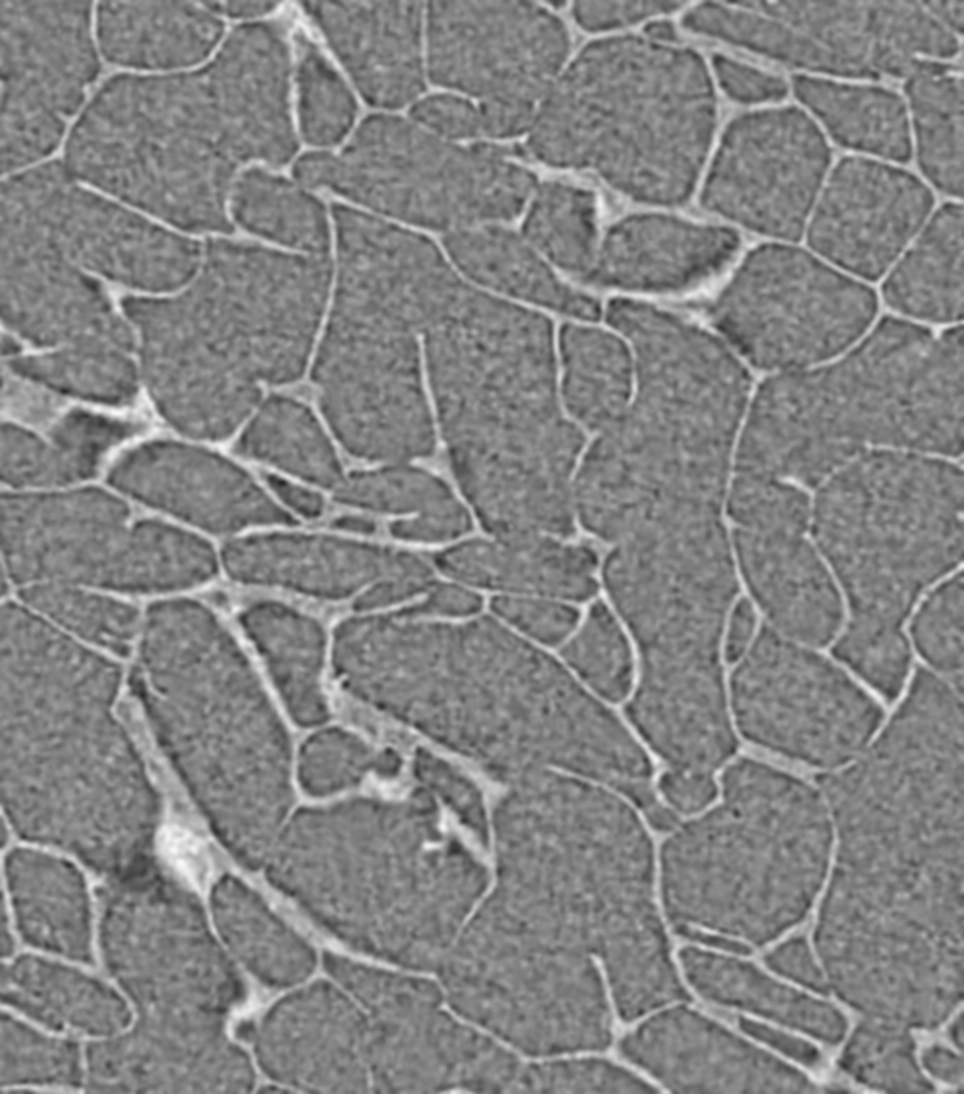 A microCt scan of a lyophilized cake assessing uniformity in it's wall structure.