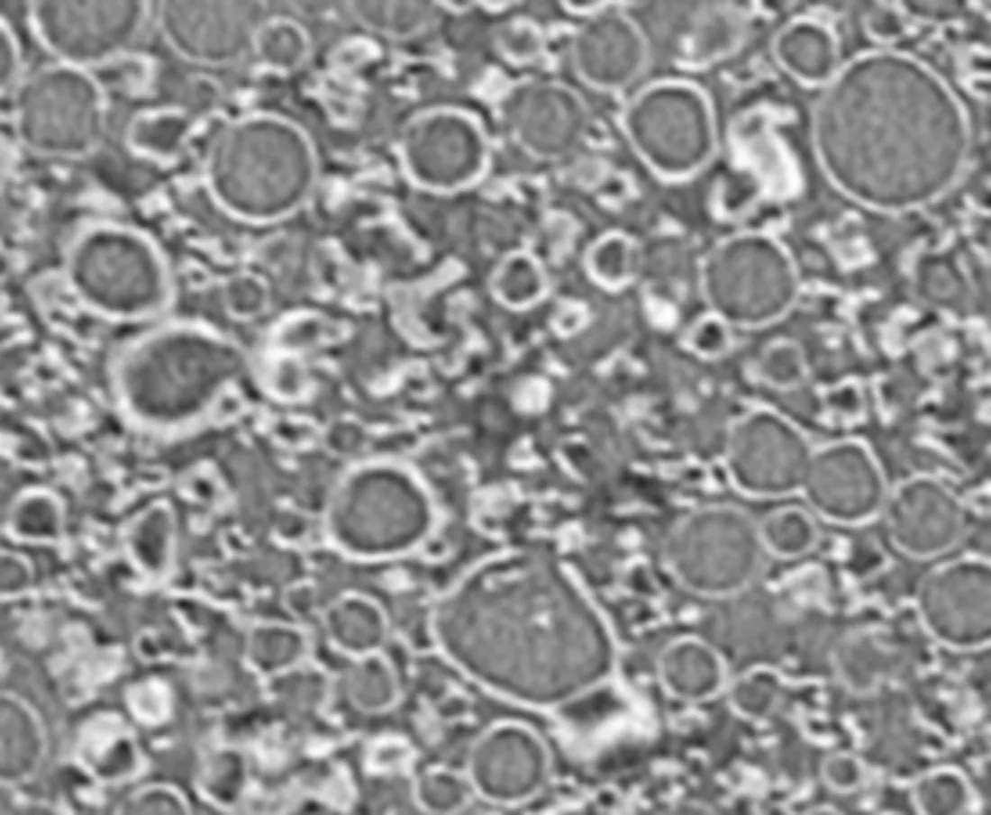 A single slice of a micro ct image of a spray dried dispersion.