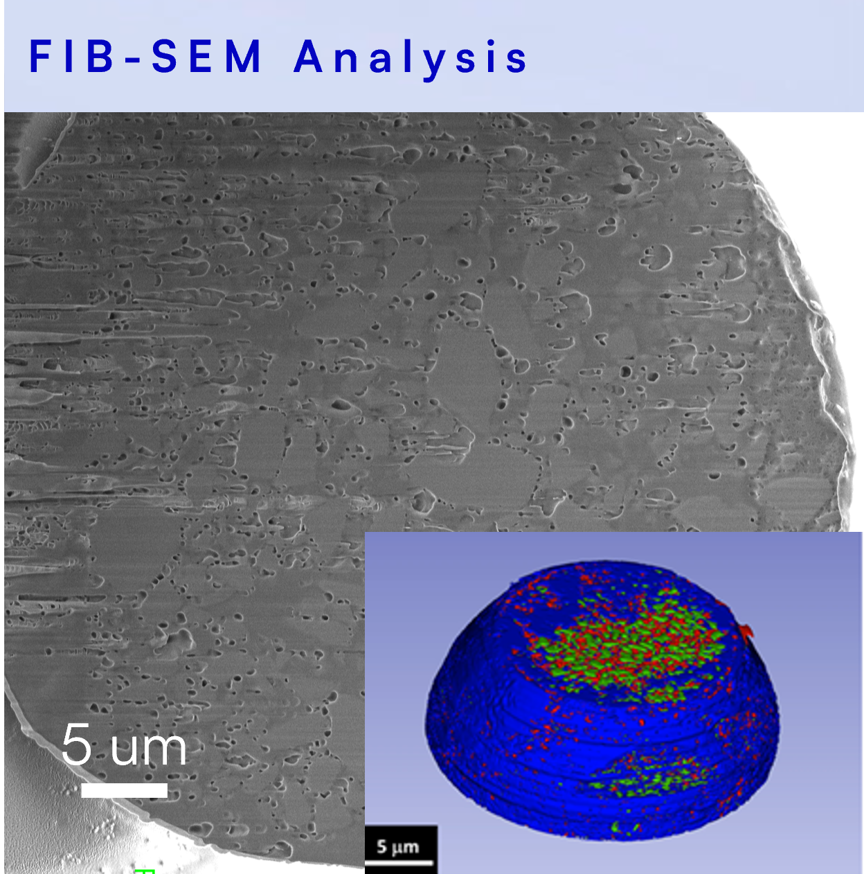 FIB-SEM cross-section of a PLGA microsphere revealing interior porosity and drug particle distribution