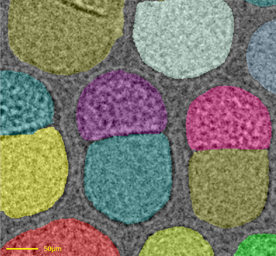 mRNA lipid nanoparticle segmented using seg2D deep learning showing classified particle regions and structural boundaries