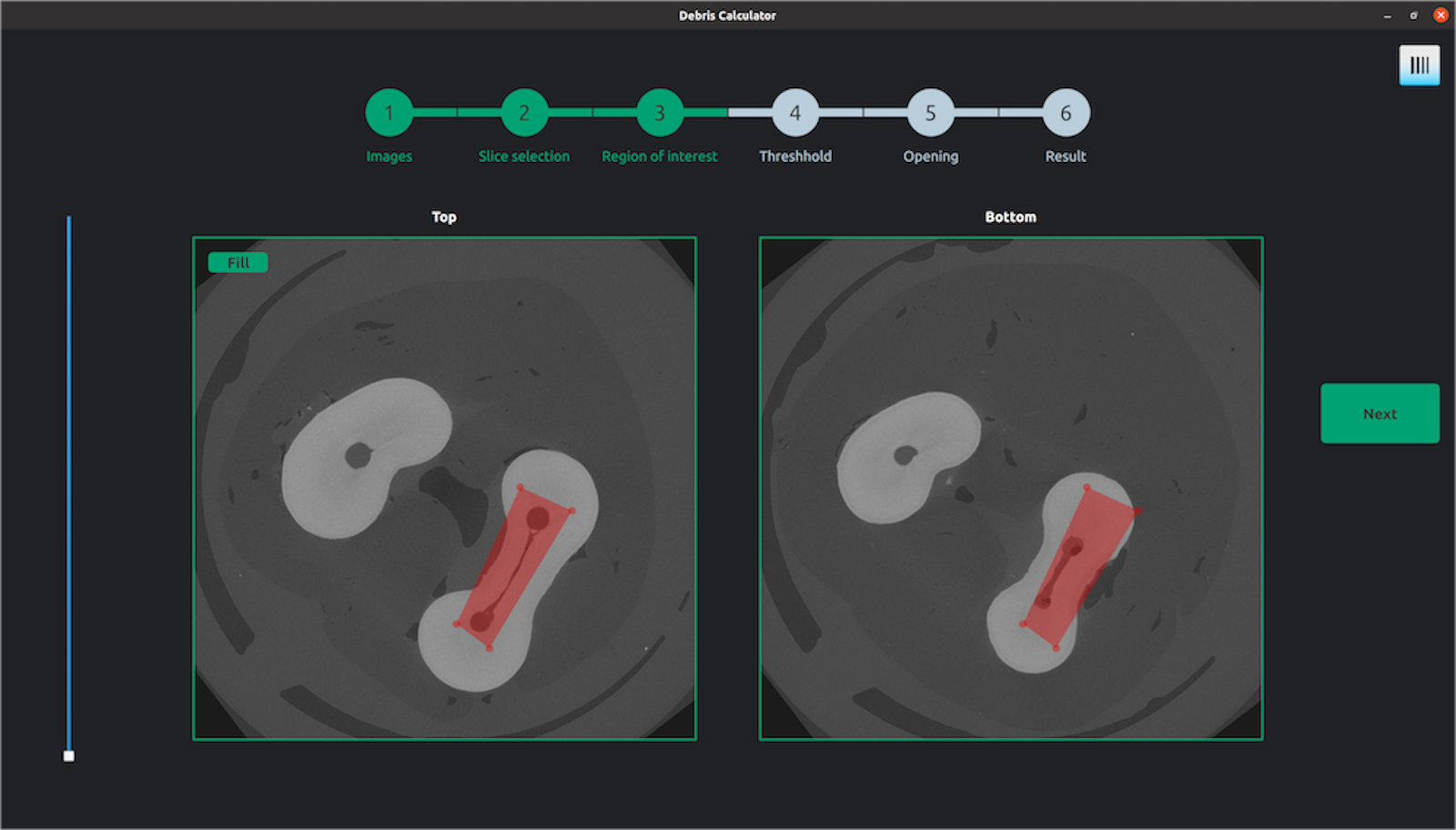 Tool voor medische beeldanalyse voor tandheelkunde Ugent