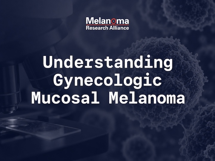 Melanoma Isn't Always Skin Cancer: Understanding Gynecologic Mucosal Melanoma