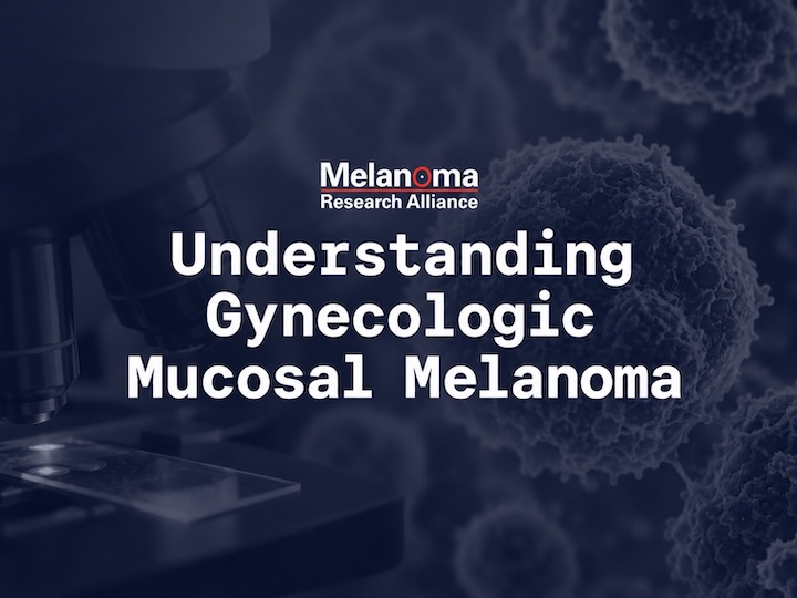 Melanoma Isn't Always Skin Cancer: Understanding Gynecologic Mucosal Melanoma