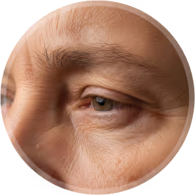 close up view of eye wrinkles