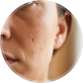 close up view of visible skin pores
