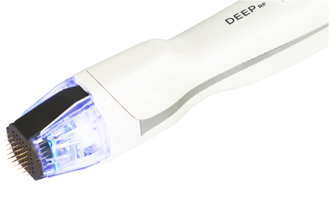Close up view of DeepRF Tip