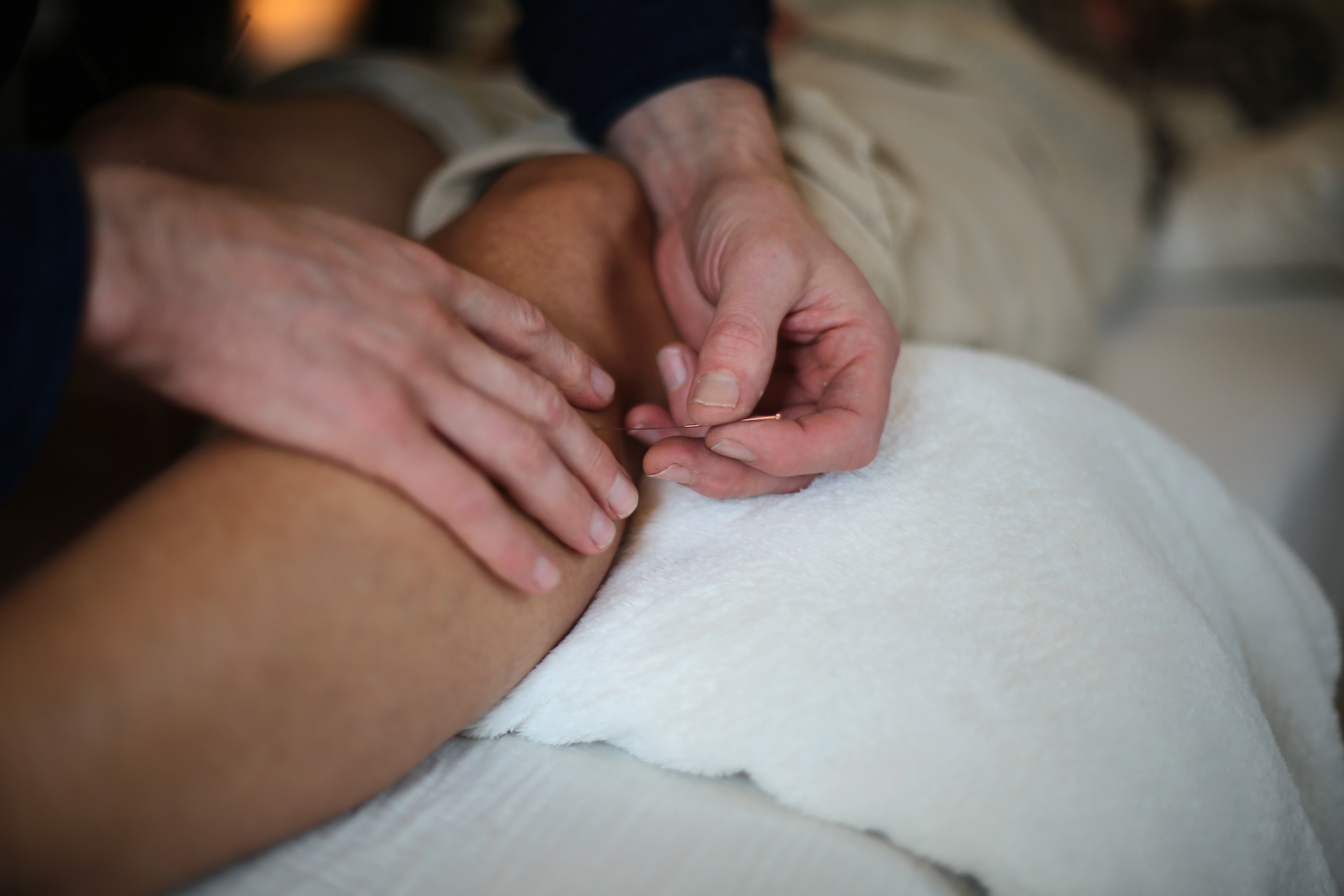 Close-up of hands inserting acupuncture needle into a person's leg over a white towel.