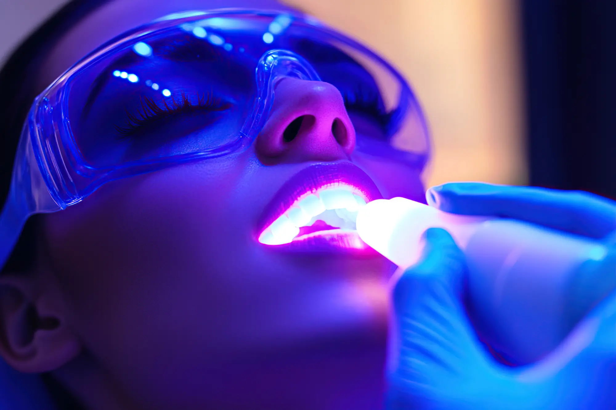 How Does Professional Teeth Whitening Work?