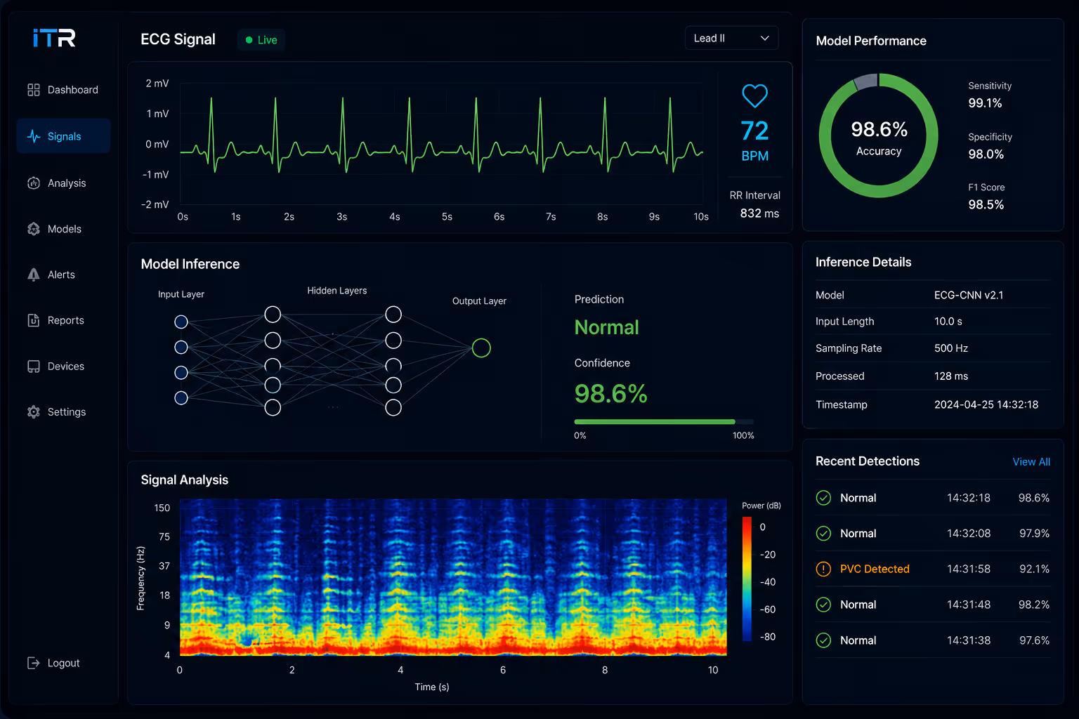 Engineers reviewing an AI-powered ECG dashboard that shows live heart signals, neural network inference, model performance metrics, and recent detection events on a dark UI.