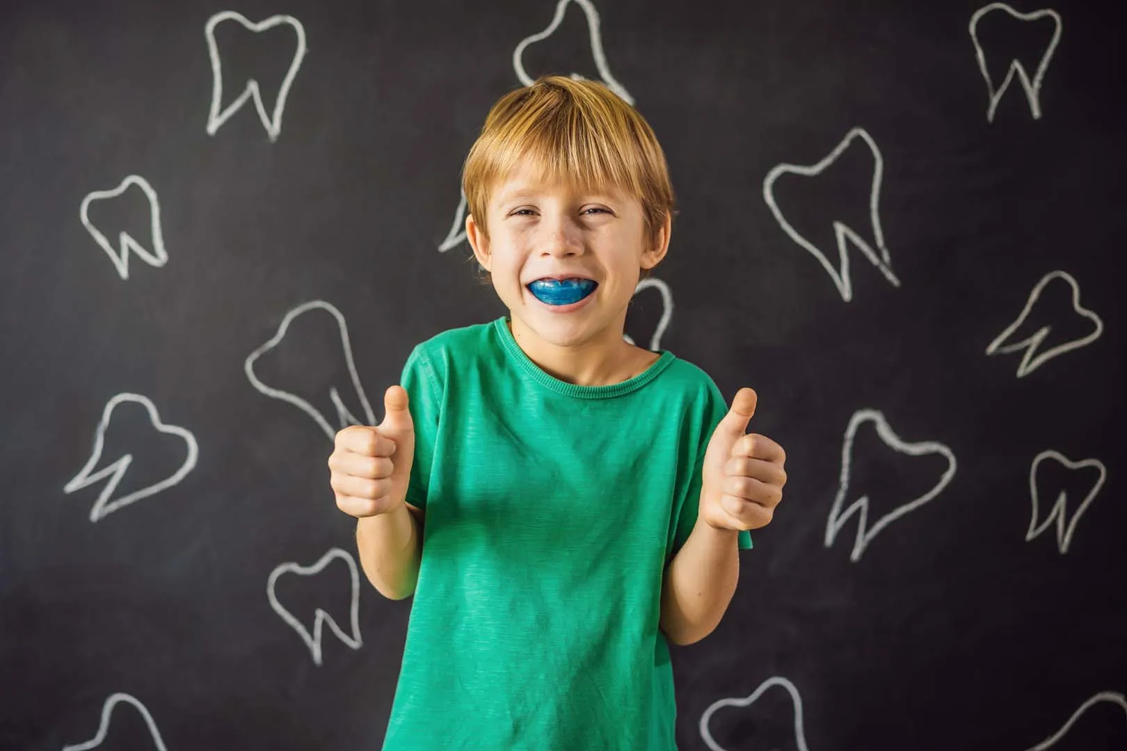 The Benefits of Custom Mouthguards for Young Athletes