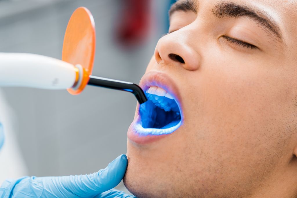 Laser Teeth Whitening in Brooklyn