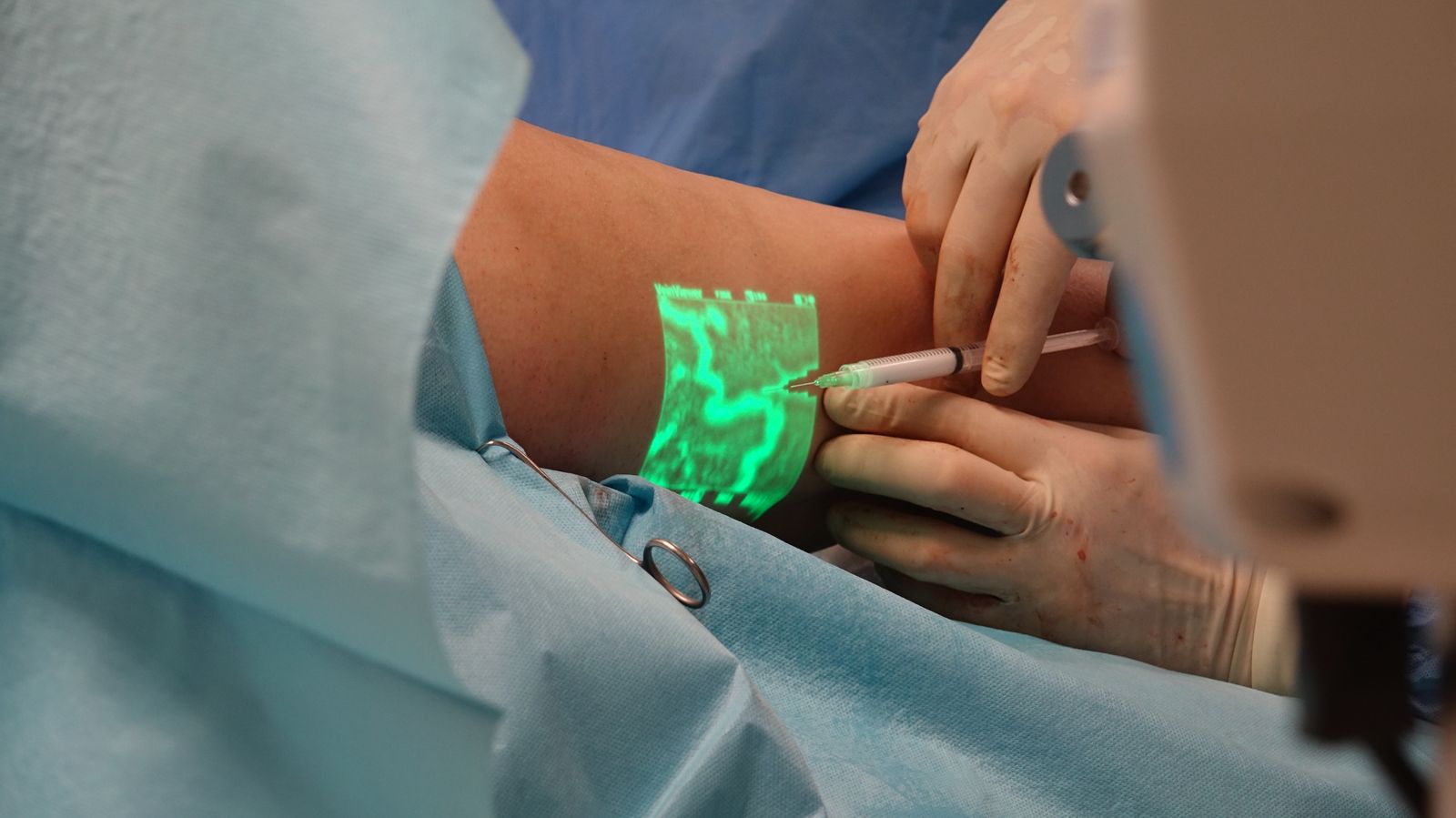Practitioner using a vein illuminator to guide a fine-needle injection during treatment