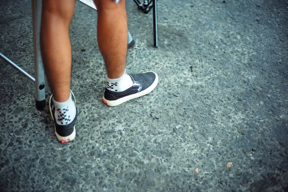 Cellulitis in the Leg