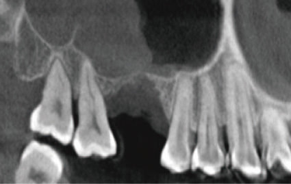 Preoperative CT