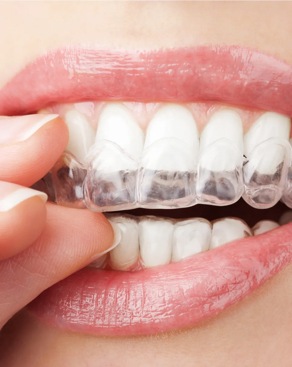 We’ll take your worries