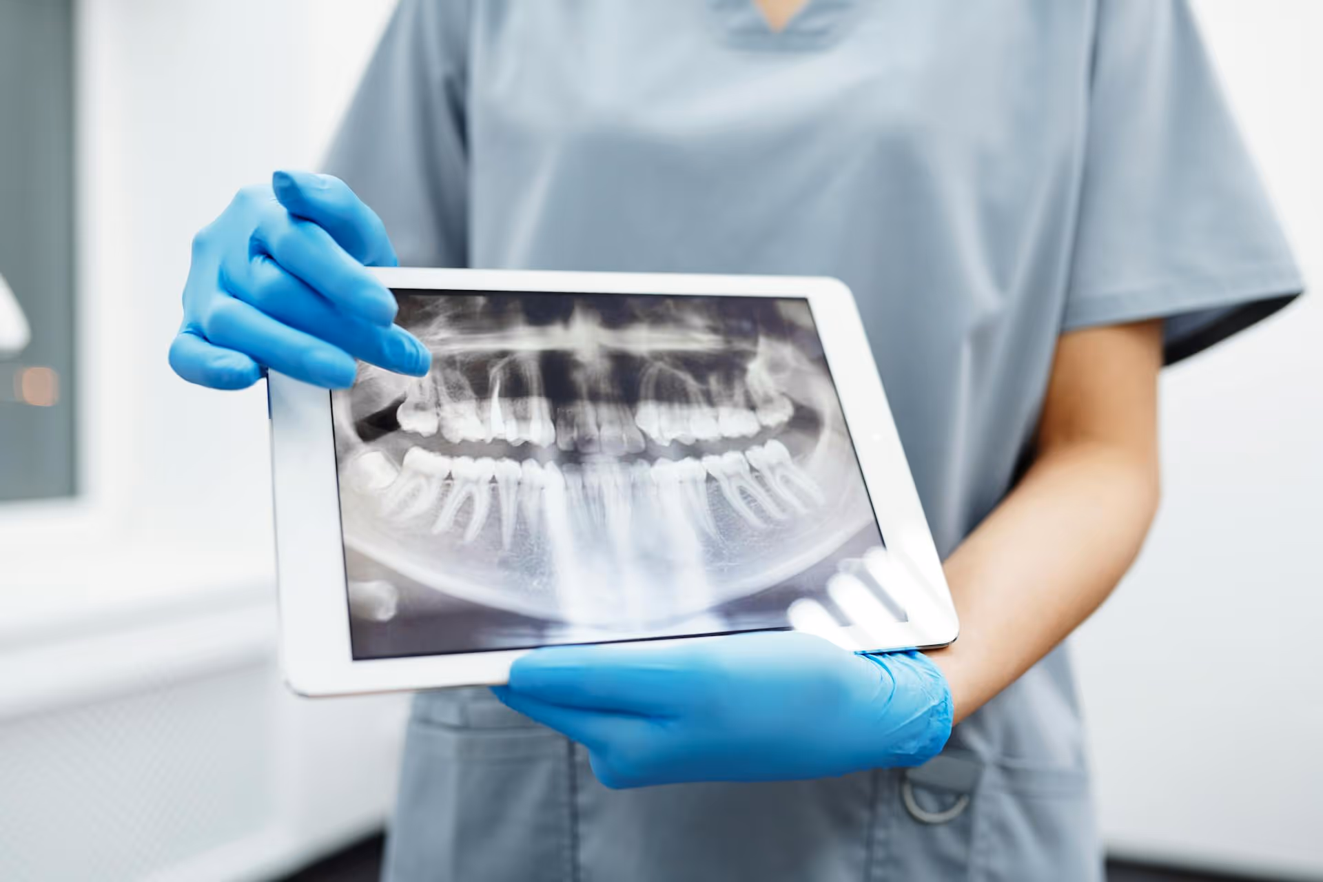 Understanding Root Canal Treatment Benefits