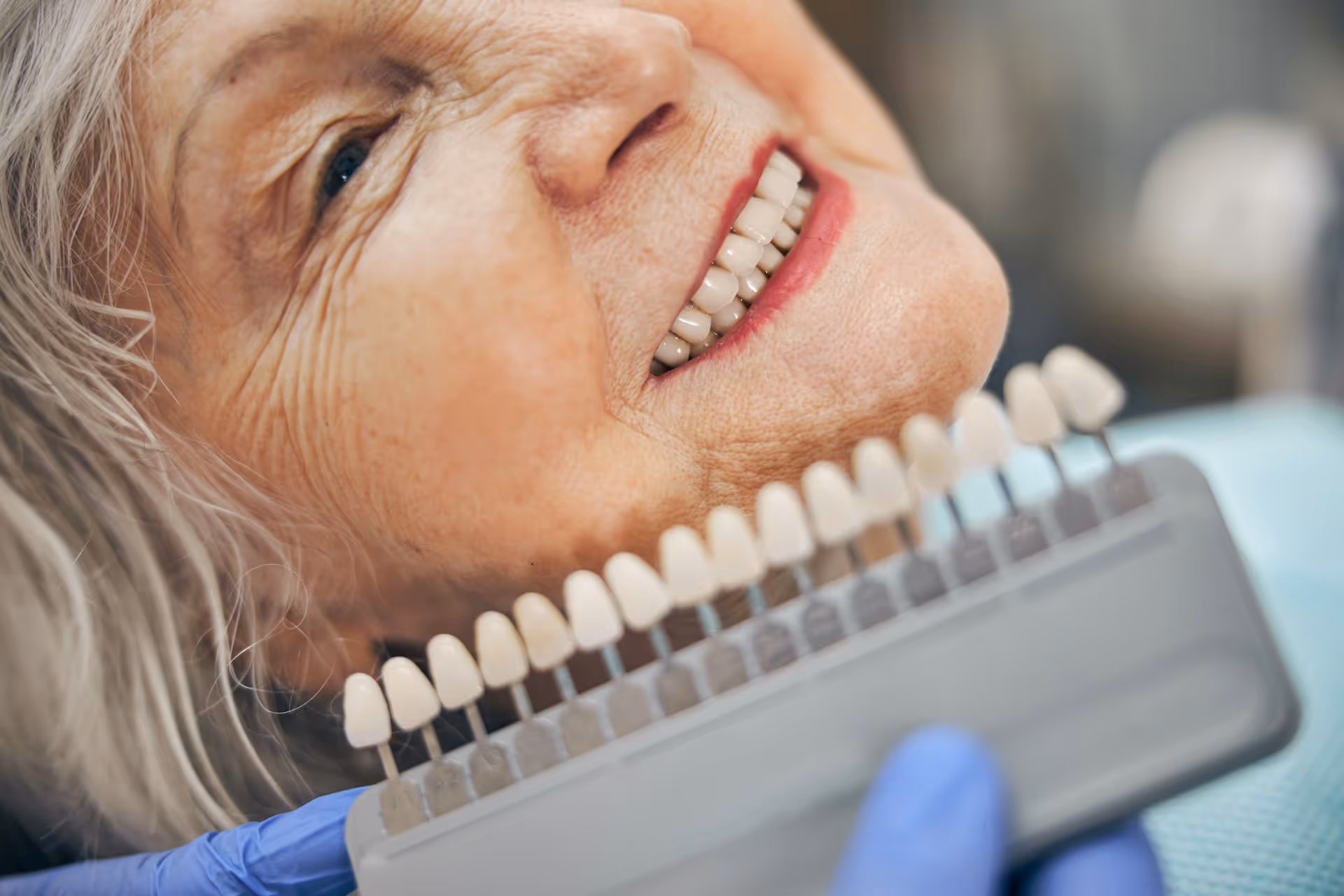 How Implant-Supported Dentures Improve Elderly Oral Health