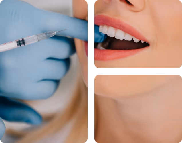 Arestin local antibiotics benefits at Shrouf Dental House