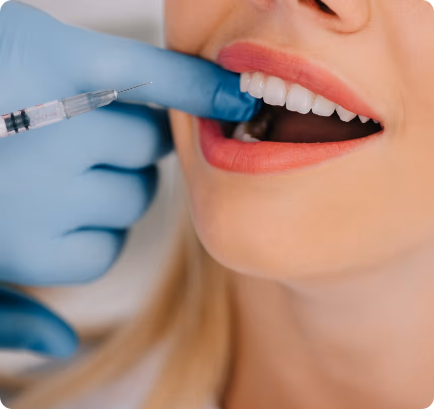 Arestin local antibiotics benefits at Shrouf Dental House