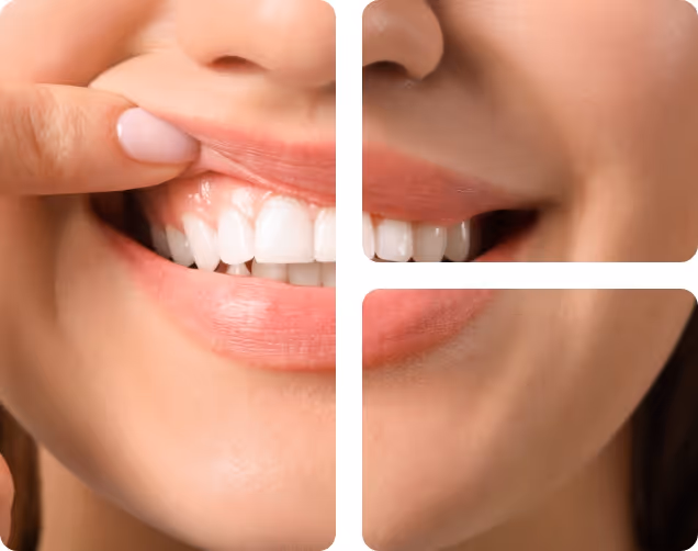 Gum & Oral Health benefits at Shrouf Dental House