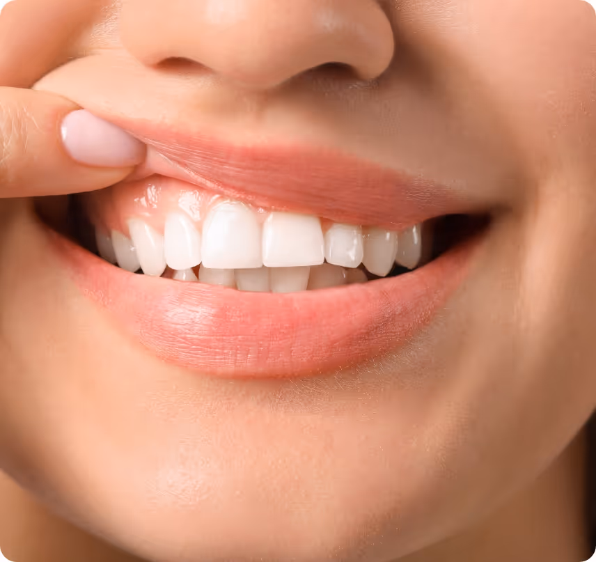 Gum & Oral Health benefits at Shrouf Dental House