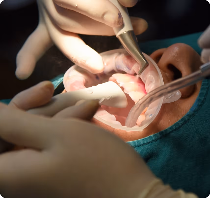 When do you need Gum & Oral Health at Shrouf Dental House